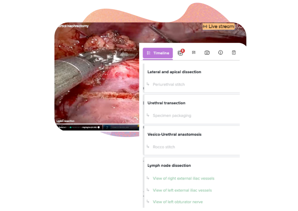 partial nephrectomy live stream