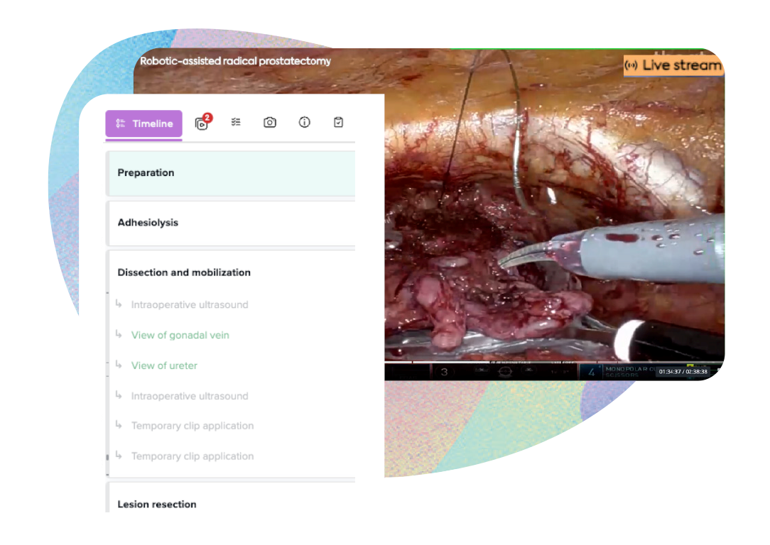 Robot-Assisted Radical Prostatectomy live stream