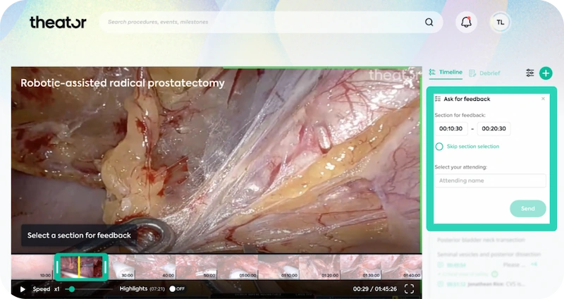 Screenshot from the Theator platform showing a still from a video of a robotic-assisted radical prostatectomy. Next to the video still, there are annotations showing the procedure timeline and a form to ask for feedback.